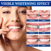 Dental Teeth Whitening Pen Tooth Cleaning Rotary Peroxide Bleaching